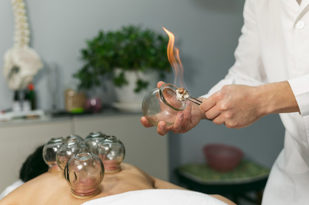 Man performing fire cupping therapy on a patients back with glass cups