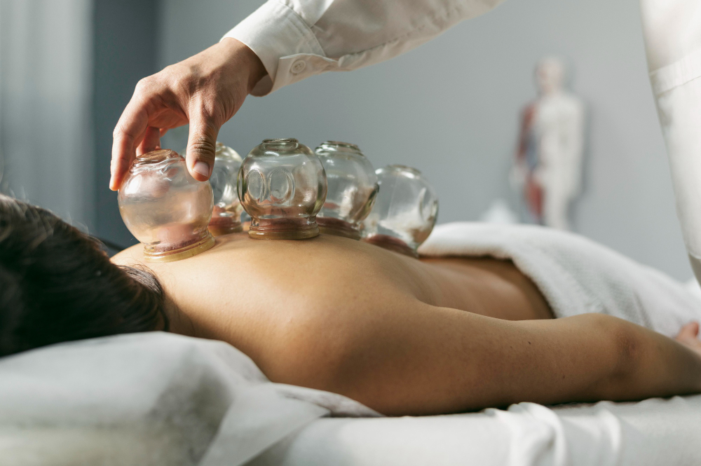 Person receiving cupping therapy on back